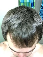 El crecimiento del cabello aceites esenciales cuidado del cabello esencia Original auténtico 100% pérdida de cabello líquido salud belleza suero denso para el crecimiento del cabello