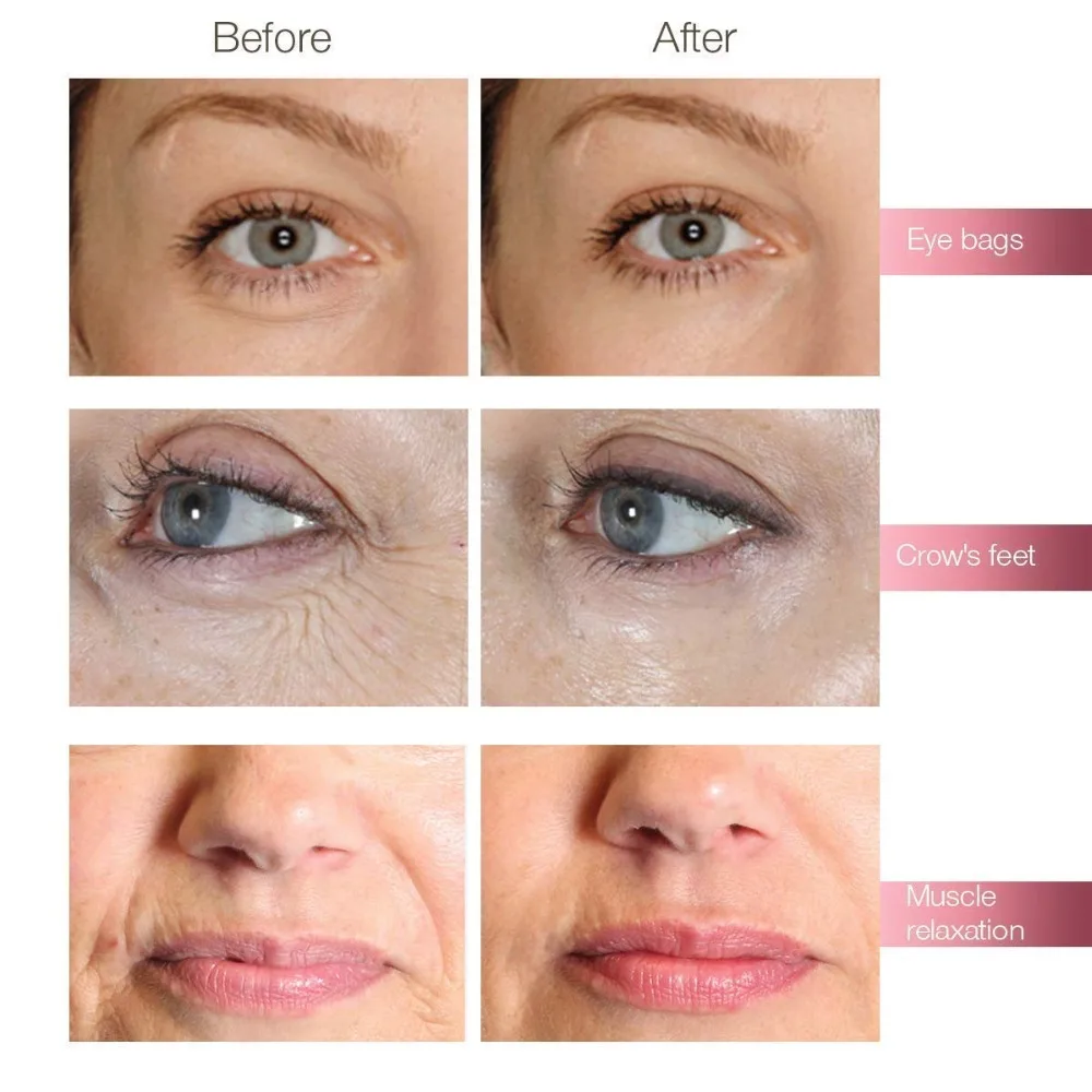 61h0PHAPKJL._SL1200_