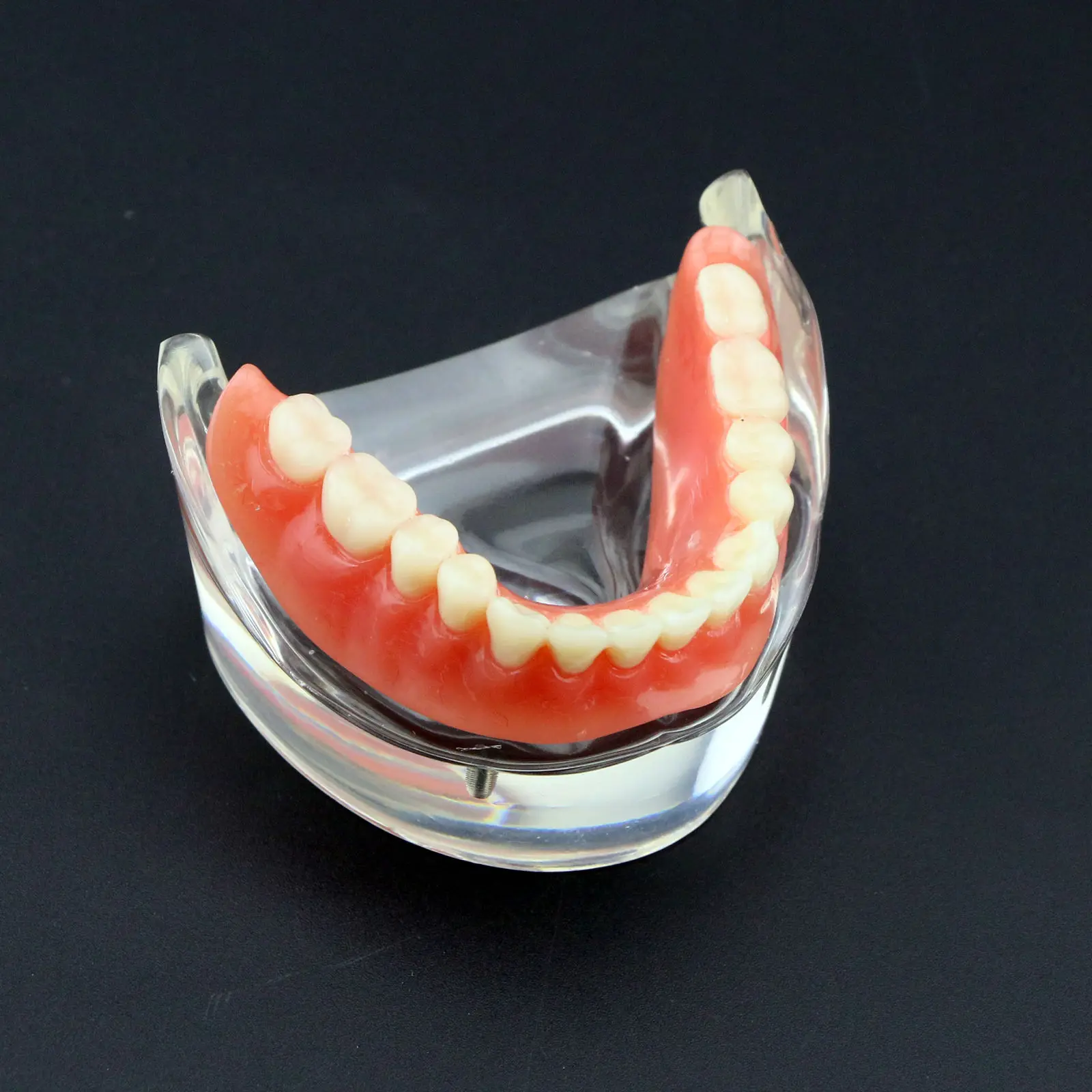 Стоматологическая Overdenture уступает с 2 имплантатами Demo модель исследования модель