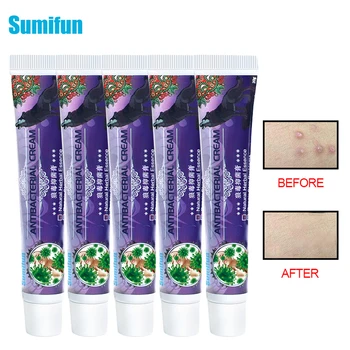 

Sumifun 5pcs Psoriasis Ointment Antibacterial Cream Skin Care Product Dermatitis Eczema Treatment Itching Medical Plaster D3469