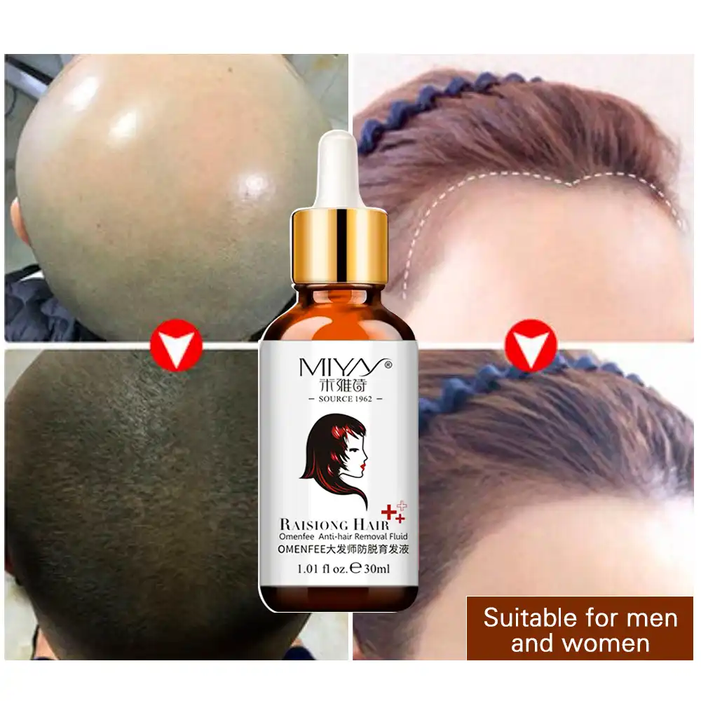 Hair Oil Hair Care Fast Powerful Hair Growth Products Regrowth