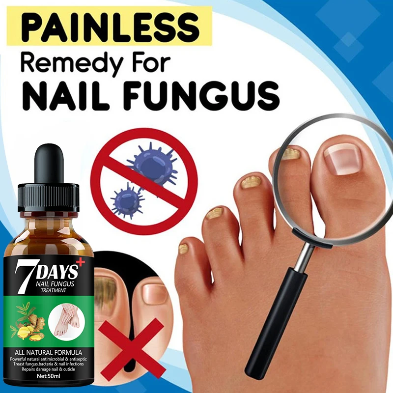 Nail Fungus Treatment Essence Serum Care Hand and Foot Care Removal Repair Gel Anti-infective Paronychia Onychomycosis