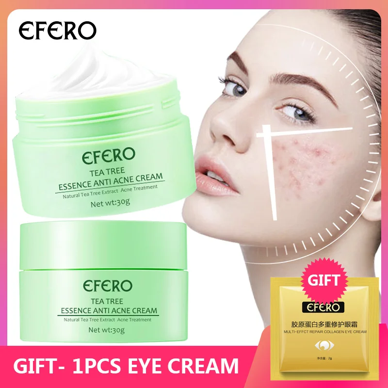 eye cream gift EFERO крем для лечения акне эссенция чайного дерева против рубцов от акне крем для удаления кожи уход за кожей Отбеливающий Крем для лица Ремонт прыщей для акне - Цвет: eye cream gift