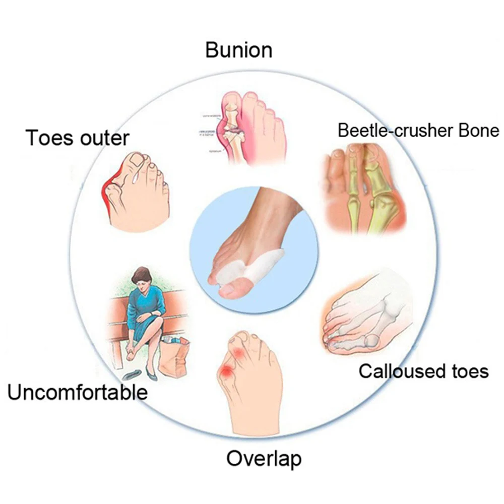 Комплект из 2 предметов, от болезненной опухоли на корректор-выпрямитель дышащая косточка на большом пальце Силиконовые серьги гелевые носки разделитель пальцев массажер для ног