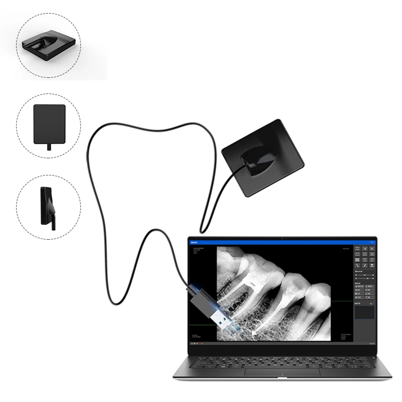 

Стоматологический USB Xray rvg датчик интраоральный