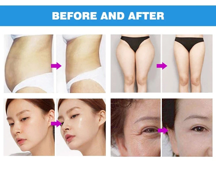 Настольный V10 Корректор тела лифтинг для лица потеря веса power shape III Velashape+ rf+ 40 кГц ультразвуковая кавитация+ Био система