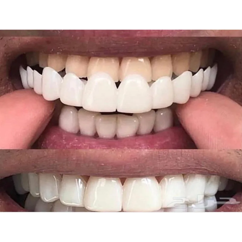 Tooth Cover Soft Silicone Gel Dental Oral Upper Lower Fake False Teeth Cover Smile Veneers Dentures Braces Dental Equipment Whitening Molds