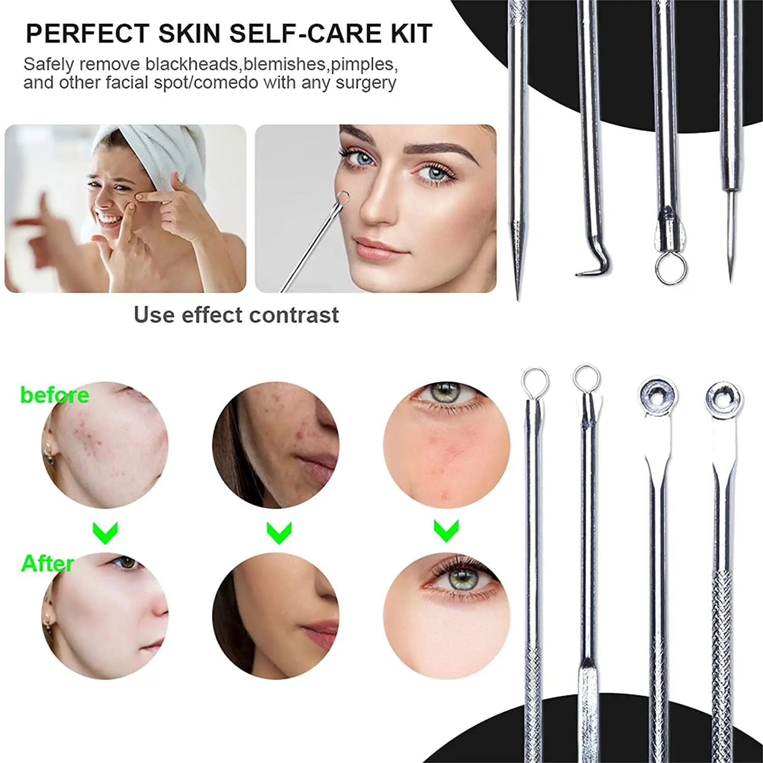 Blackhead Acne Remover 4pcs Comedone Black Head Blemish Pimple Removal Needle Face Skin Beauty Care Cleansing Pore Cleanser 3