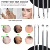 Blackhead Acne Remover 4pcs Comedone Black Head Blemish Pimple Removal Needle Face Skin Beauty Care Cleansing Pore Cleanser 3