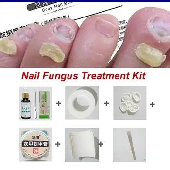 

Chinese Medicine Herbs Nail Repair Liquid Fungus Treatment Onychomycosis Manicure Kit Infection Fingernails Toenails Care Y801