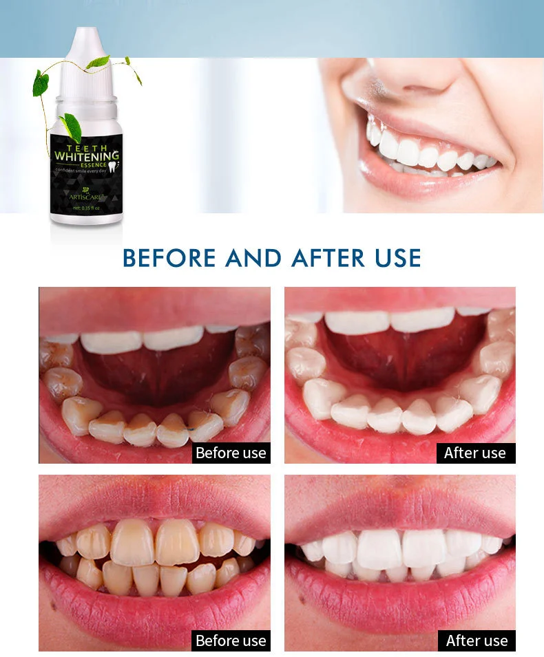 teeth-whitening-serum_11