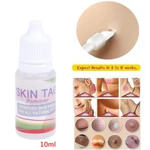 Средство для удаления кожных тегов 12 часов Tu kill, медицинское средство для удаления кожных тегов, средство для удаления бородавок на ногах, средство для удаления кукурузы, 10 мл