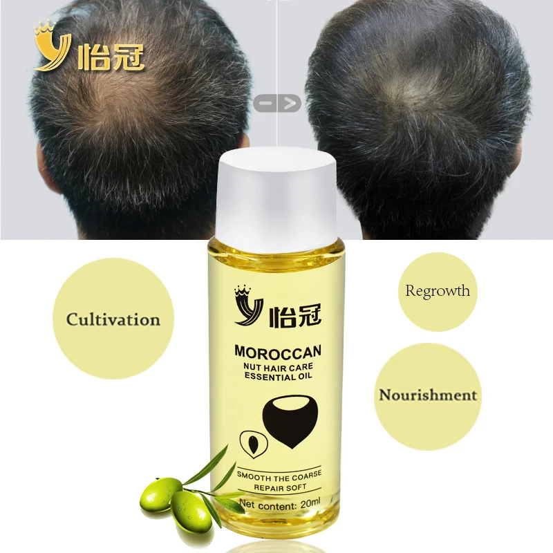 20 мл масло для волос эссенция для быстрого роста волос облысение натуральные травяные мощные средства для лечения роста волос средство против выпадения волос