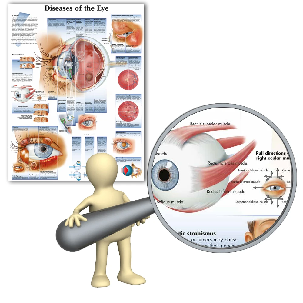 WANGART плакат болезни глаз диаграмма плакаты рефрактивов холст печать настенные картины для медицинского образования домашний декор