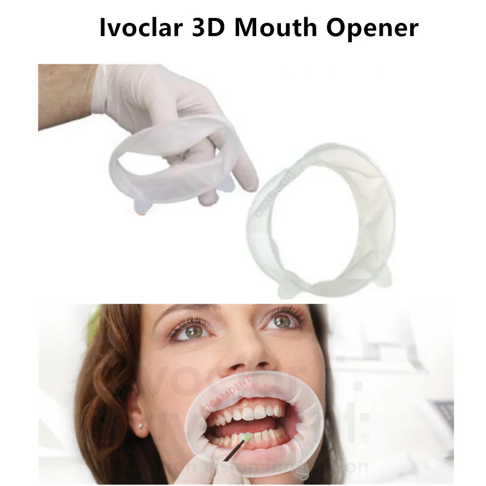 OptraGate abridor de boca Dental 3D para adultos y niños, Retractor de