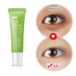 Remove Eye Bags Eyes Care Cream Anti Dark Circle Removal Wrinkle Gel Moisturizing Nourishing Serum Anti Aging Tighten Eye Skin