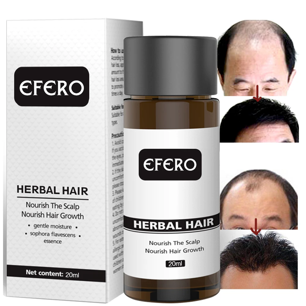 

Hot Hair Loss Treatment Serum Anti-Hair Loss Serum Essential Oils Dense Hair Growth Serum Hair Care Prevent Baldness dropship