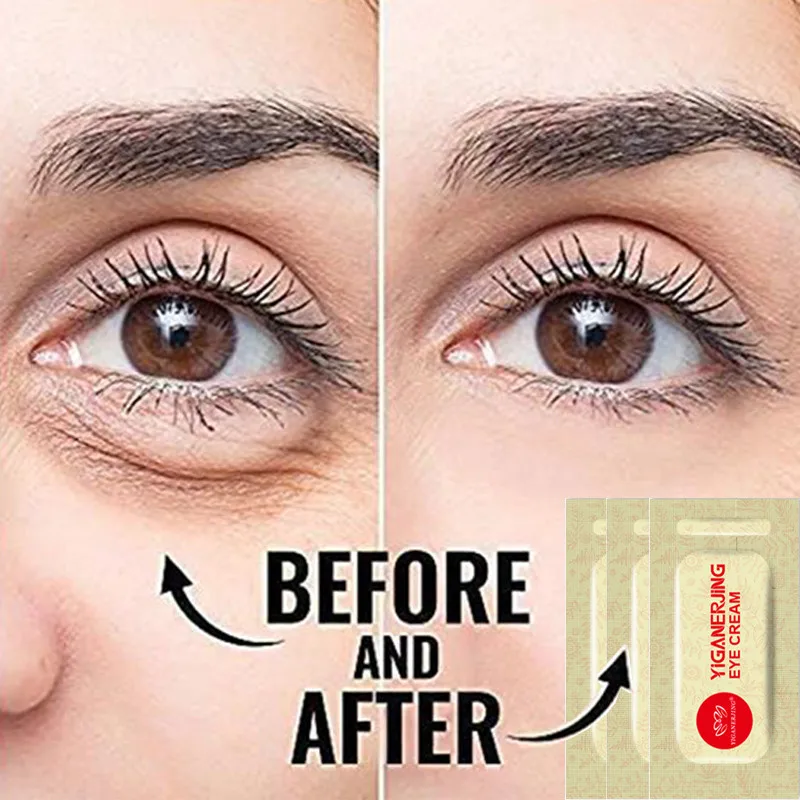 

5PCS Yiganerjing Collagen Eye Cream Anti-Wrinkle Anti-aging Hydrate Dry Skin Remover Dark Circles Eye Care Against Puffiness