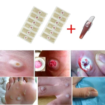 

New Wart Removal Patch Painlessly Remove Feet Callus Cutins Corn Remover Pads Soften Skin Cutin Feet Care