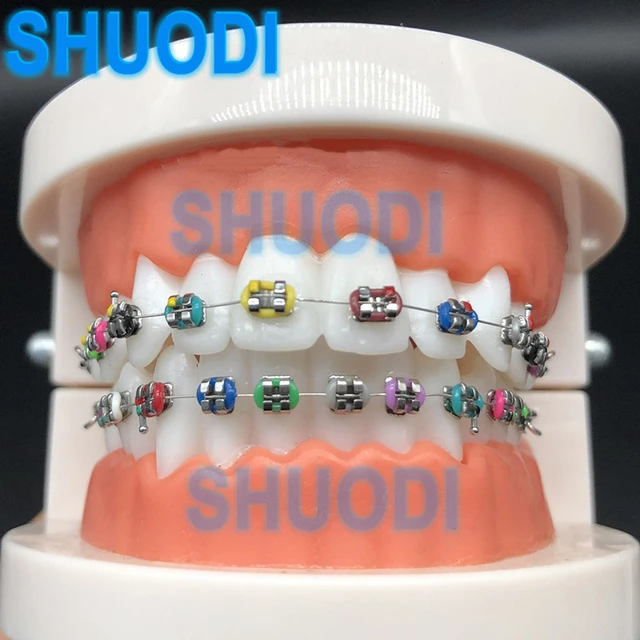 Modèle de dent dentaire avec support/modèle d'enseignement orthodontique  avec Tubes buccaux/modèle de dent de pratique orthodontique avec support 1  pièce - AliExpress