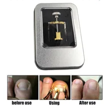 Вросший носок фиксатор для НОГТЯ ПЕДИКЮР цинковый сплав сталь коррекция ногтей инструмент для ухода за ногтями для женщин и мужчин M3