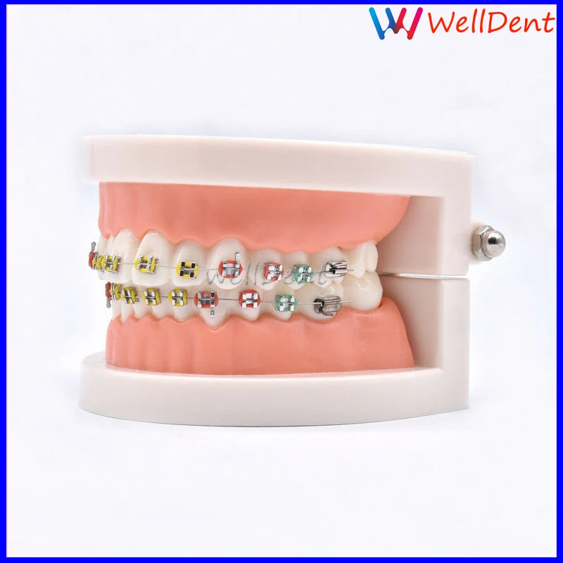 Dental-Orthodontic-Teeth-Hoop-Model-Metal-Brackets-Ligature-_57 (2)