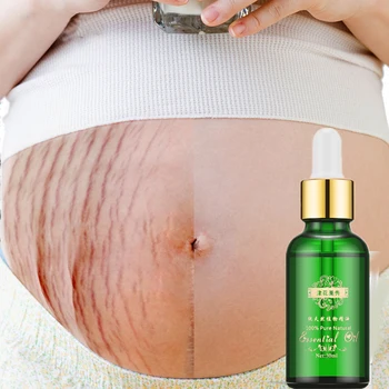 

New Stretch Marks Remover Essential Oil Skin Care Treatment Cream For Stretch Mark Removal Maternity Slackline For Pregnant Oils
