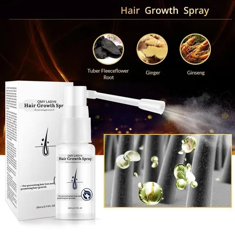 OMY LADY Ginger против выпадения волос спрей для роста эфирное масло жидкость мужчин