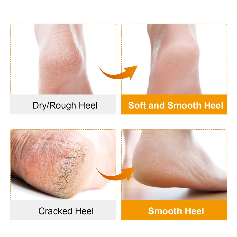 Soft Silicone Moisturizing Gel Open Toe Socks For Foot Care