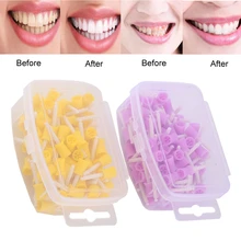 

100pcs/set Dental Polishing Rubber Polisher Cup Teeth Stain Removal Whitening Dentist Tool