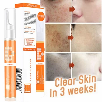

Instant Blemish Removal Gel Vitamin C Whitening Anti Freckle Cream Effectively skin tag Remove Freckle Pigmented Melanin Spots