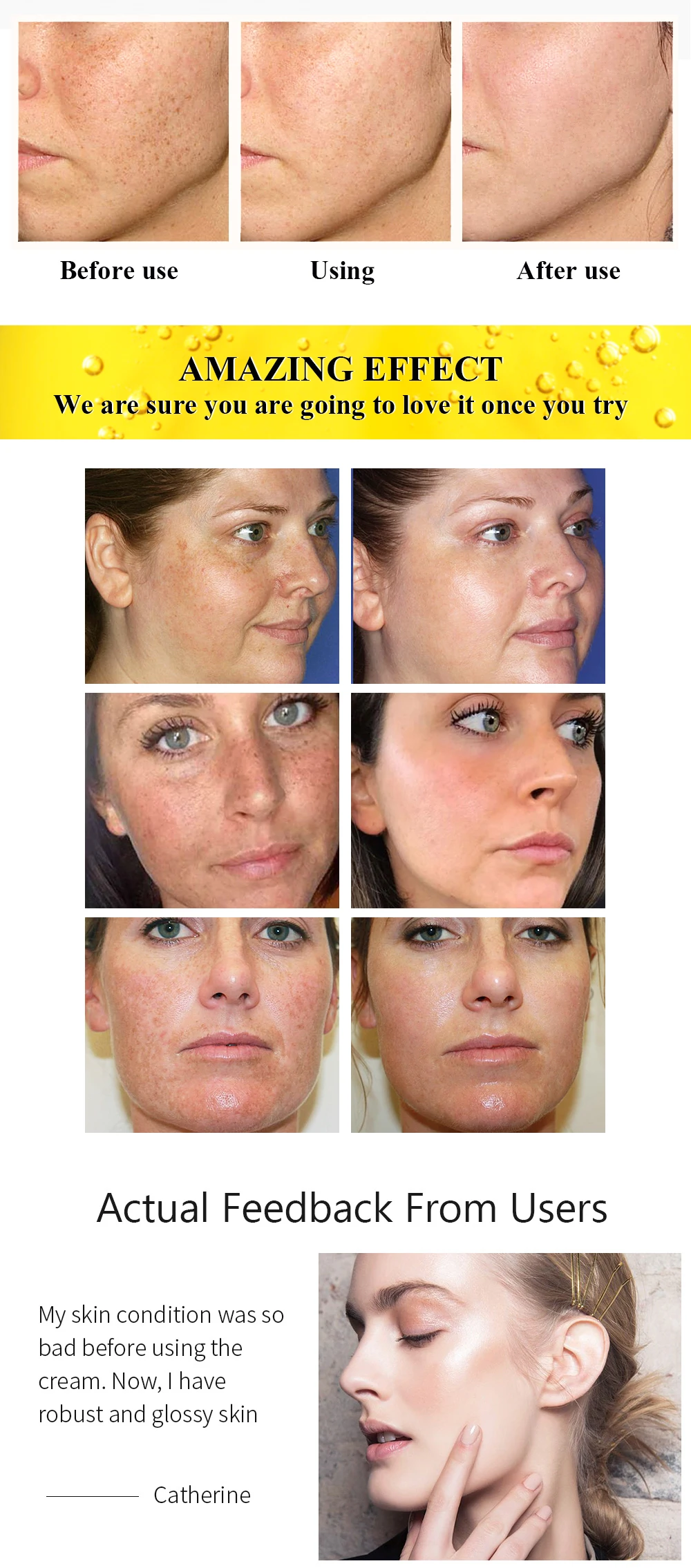 BREYLEE Vitamin C 20% VC Whitening Facial Cream 7 Hb4e100464ca646dc895d1241ea2df194k