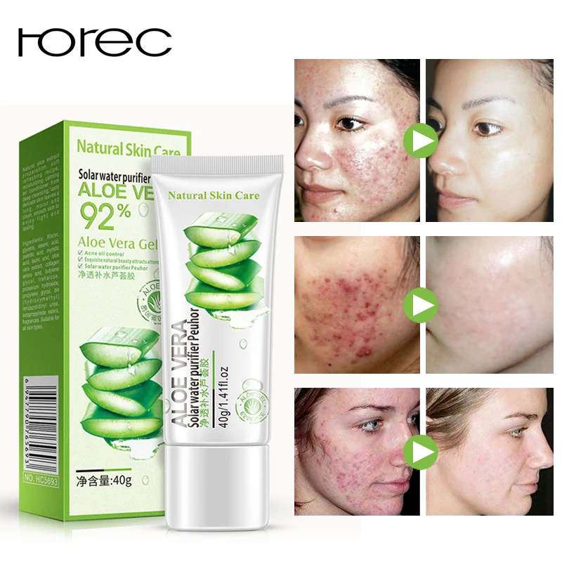 

ROREC Natural Aloe Vera Smooth Gel Acne Whitening Treatment Face Cream for Hydrating Moist Repair After Sun Sleeping Mask