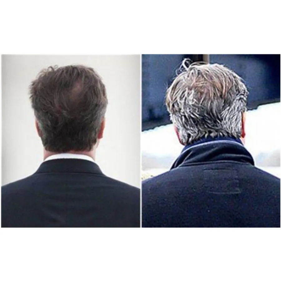 White Hair Turn Black Promote Hair Growth Alopecia Bald Cure Products Stop Loss Polygonum Multiflorum Powder for Men Women