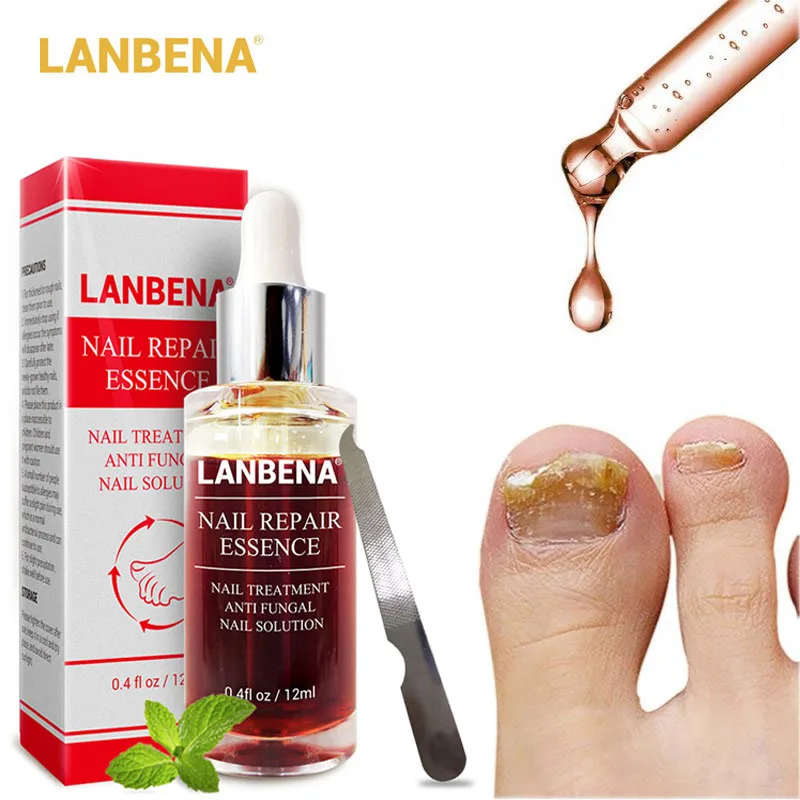 

LANBENA Fungal Nail Repair Essence Serum Treatment Care Foot Nail Fungus Removal Gel Anti Infection Onychomycosis 15ML