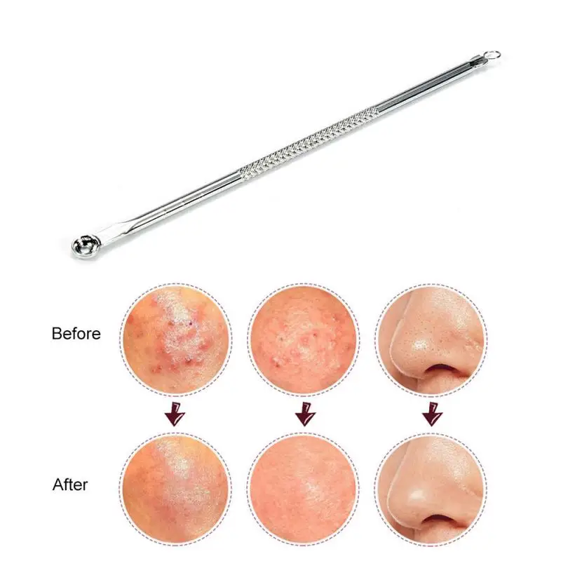 Blackhead Comedon Acne Pimple Remover - Tool Spoon Needle Hudvårdsverktyg Ansiktporrengöring