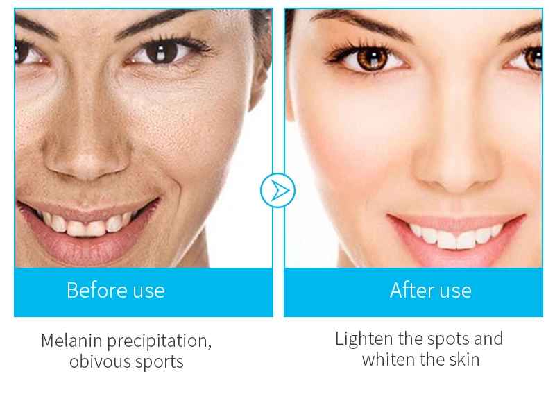 Argireline Collagen Peptides Face Serum Cream AntiAging Wrinkle Lift Firming Whitening Face Cream Moisturizing Essence Skin Care