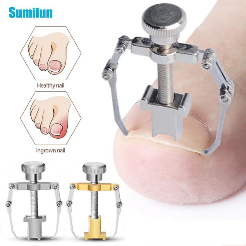 

0.69$ 1Pcs Recover Ingrown Toe Nail Correction Paronychia Nail Brace Tool Pedicure Foot Nail Care Toenails Clip Brace Correcect