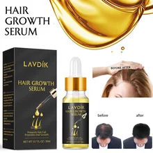 Productos anticaída del cabello