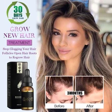 Продукты против выпадения волос уход за волосами эфирные масла, способствующие быстрому росту волос натуральный экстракт здоровья реставратор волос