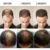PURC Hair Growth Spray Fast Growing Hair Oil Loss Treatment Thinning Preventing Hair Care Beauty Products 30ml for Men Women