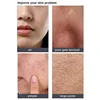 Diamond Microdermabrasion 9 Tips 3 Wands For Facial Skin Peeling Machine Dermabrasion Tips Replacement Deep Clean Tool 5