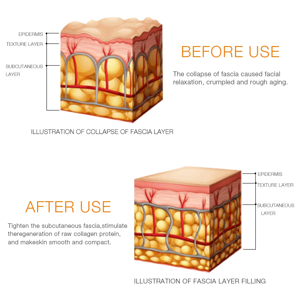 rf ems dispositivo beleza facial rosto pescoço