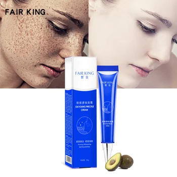 

Reduces Age Spots Freckles Acne Treatment Blackhead Removal Anti Acne Cream Oil Control Shrink Pores Acne Scar TSLM1