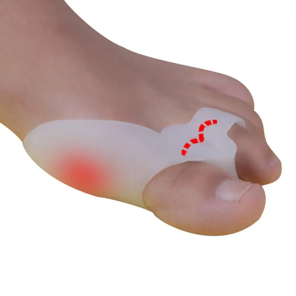 2Pcs Silicone Bunion Toes Corrector Orthotics Straightener Separator Ease Pain Relief Protect Your Bunion For Women