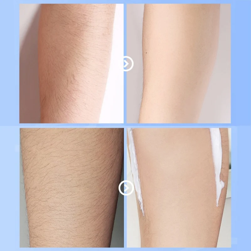 Крем для удаления волос на теле, для мужчин и женщин, для выпадения ...