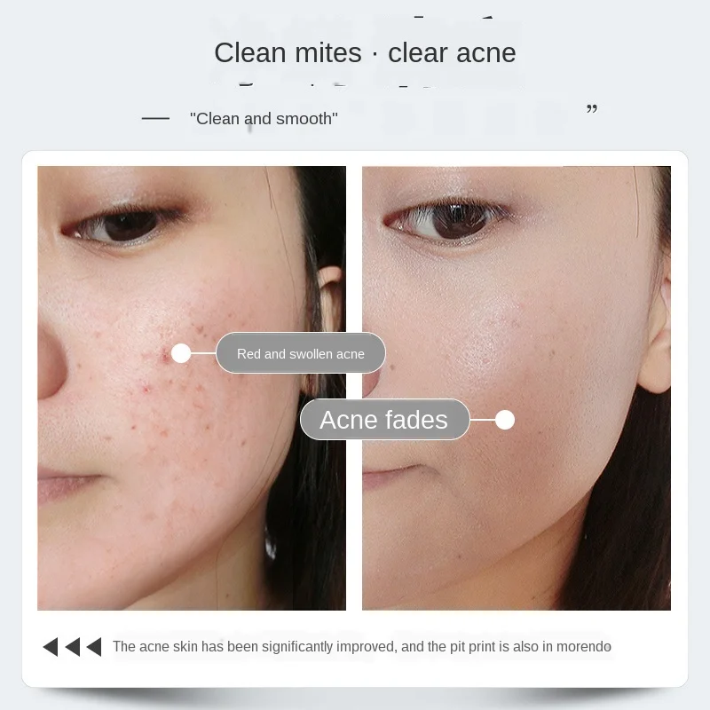 2020 Pin Up Goat Milk Soap Remove Pimple Pore Acne Sea Salt Soap Face and Body Treatment Cleaner Moisturizing Skin Care Basis 2020 Pin Up Goat Milk Soap Remove Pimple Pore Acne Sea Salt Soap Face and Body Treatment Cleaner Moisturizing Skin Care Basis