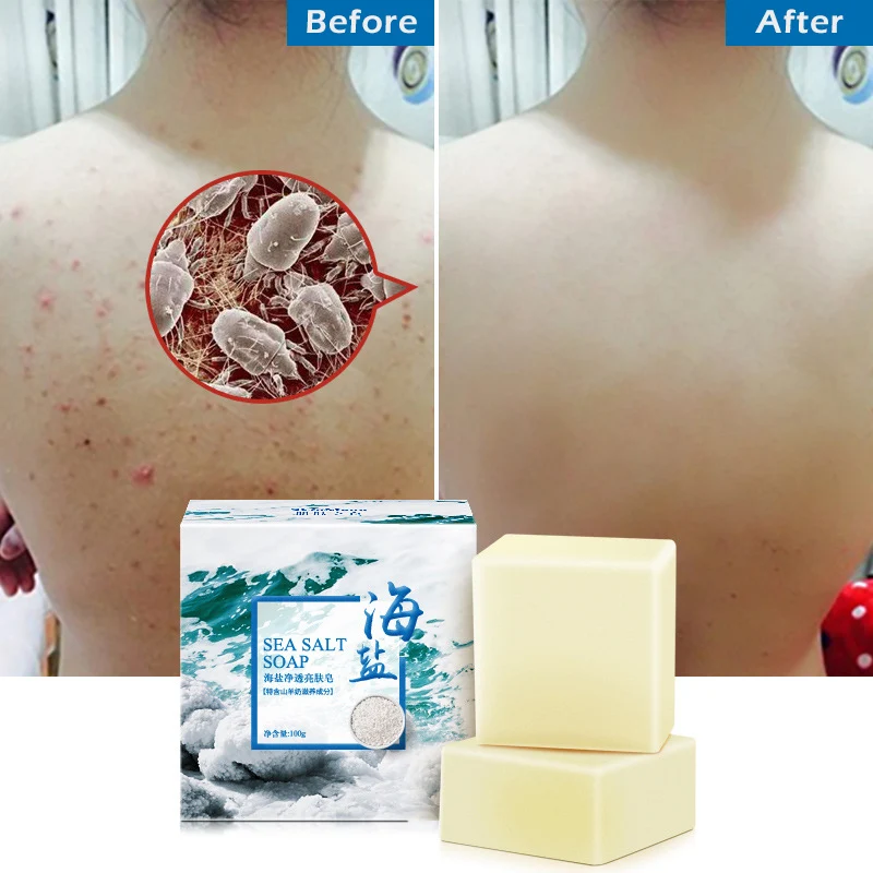 

100g Sea Salt Soap Cleaner Removal Pimple Pores Acne Treatment Goat Milk Moisturizing Face Care Wash Basis for Beauty Soap TSLM1
