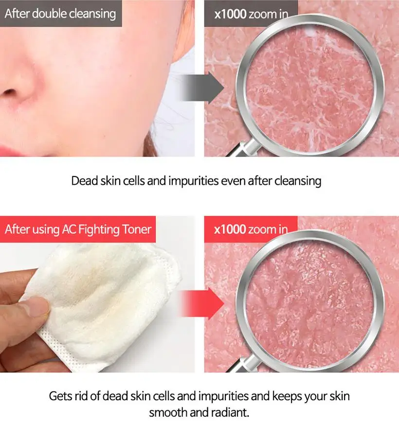 TIAM AC Fighting AHA BHA PHA тонер 180 мл Тонер для лица мягкое средство для отшелушивания для лица акне лечебная сыворотка Удаление угрей Корея Косметика