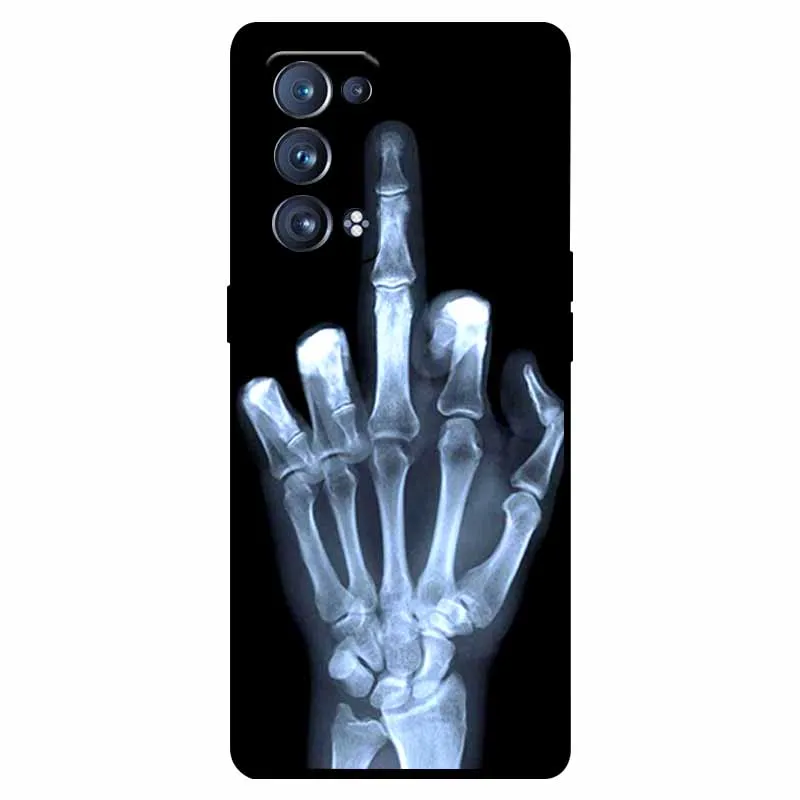 Shockproof Soft Silicone TPU Back Cover for Oppo Reno 6 Pro 5G - Cute and Durable